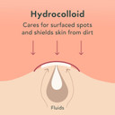 Rael Pimple Patches, Miracle Invisible Spot Cover - Hydrocolloid Acne Patch, Treatment For Breakouts, Absorbs Zits & Blemish, Korean Skin Care, 2 Sizes (24 Count)