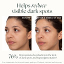 Brightening Saffron Serum - Discoloration Correcting Face Serum, Dark Spot Corrector, Vitamin C Alternative & Hyperpigmentation Treatment - Leaves Skin With A Healthy Glow (0.17 Oz)