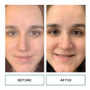 Replenix Gly-Sal Clarifying Pads, Medical-Grade Glycolic Acid & 2% Salicylic Acid Exfoliating Pads For Acne-Prone Skin, Oil-Free (60 Ct.)