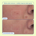 Skinfix Resurface+ Aha/Bha Niacinamide Exfoliating Pads: 2% Salicylic Acid (Bha) + Ahas & Niacinamide To Target Rough Texture, Spots, Fine Lines & Acne-Prone Skin, 60 Pads