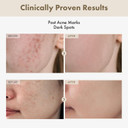 Alpha Arbutin 2% Rice Serum, Rice 746,074Ppm, Alpha-Arbutin 20,000Ppm, Glow, Glass Skin, Pigmentation, Acne Marks, Dark Spots, Even Skin Tone, Hydrating, Korean Skin Care, 33Ml / 1.11 Fl.Oz Alpha Arbutin 2% Rice Serum, Rice 746,074Ppm, Alpha-Arbutin 20,000Ppm, Glow, Glass Skin, Pigmentation, Acne Marks, Dark Spots, Even Skin Tone, Hydrating, Korean Skin Care, 33Ml / 1.11 Fl.Oz