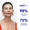 Wrinkles Schminkles Mouth & Lip Bundle Set: Mouth & Lip Wrinkle Patch, Self-Dissolving Patches For Smile Lines