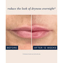 City Beauty City Lips Night Oil - Plump, Hydrate, And Restore Overnight - Anti-Aging Lip Treatment - Conditioning Lip Oil With Hyaluronic Acid & Plant Extracts