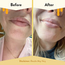 Eczema Honey Nourishing Lip Balm - Organic Chapstick For Sensitive Skin - Daily Lip Moisturizer For Very Dry Lips - Mango Butter & Honey Lip Balm - Natural Lip Care Products (1 Ct) Eczema Honey Nourishing Lip Balm - Organic Chapstick For Sensitive Skin - Daily Lip Moisturizer For Very Dry Lips - Mango Butter & Honey Lip Balm - Natural Lip Care Products (1 Ct)