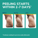 Dr. Scholl'S Rough, Dry Skin Ultra Exfoliating Foot Peeling Mask, 3 Pairs Moisturizing Socks Gently Peels And Softens, With Urea, Dry Skin Callus Remover For Feet