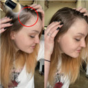 Keratin Research Hairline Filler Unisex Mineral Powder Root Touch-Up Hair Loss Concealer Scalp & Beard Bald Patch Coverage Fibers For Thinning Hair Waterproof Organic Natural Look (Medium Brown, Xl)