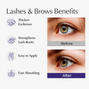 Ayumi Pure Castor Oil For Face & Body | Cold Pressed Hair Growth Oil | Castor For Eyelashes & Beauty | Cuticle Oil For Nails | Natural Hairoil For Frizzy Hair | Beardoil For Mens Grooming | 40.56Floz