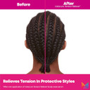 Matrix Instacure Tension Reliever Leave-In Scalp Serum - Moisturizes Dry And Irritated Scalp, Cools Tension In Braids, Protective & Tight Hairstyles, 6.8 Fl Oz