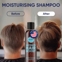 Moerie Ultimate Hair Growth Shampoo  For Longer, Thicker, Fuller Hair - Vegan Friendly Volumizing Hair Products  Paraben & Silicone Free  All Hair Types  Reverse Hair Loss  Moisturizing