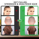 Mysense Raw Batana Oil For Hair Growth, 100% Natural Pure And Unrefined Dr. Sebi Oil, Scalp Care For Women & Men, Prevent Loss, Promote Thickness, 60 G