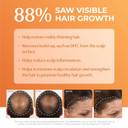 Bosrevive Volumizing Conditioner For Thinning, Color/Chemically-Treated Hair  Dht Blocker, Sulfate-Free, Vegan, Biotin, Saw Palmetto & Rosemary  Thicker, Fuller Hair  10.1 Fl Oz