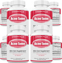 Acne Pills Supplement- Clear Skin Vitamins Pill For Oily Skin Treatment, Hormonal Blemishes, Anti Spots & Cystic Acnes Supplements For Women, Men, Teens & Adults- 240 Oral Tablets