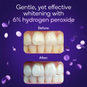 Burst Sensitive Teeth Friendly Whitening Strip Kit (Mint + Coconut) | 10 Treatments With No-Slip Grip | Visible Results In Just 15 Minutes