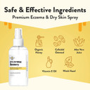 Eczema Honey Premium Witch Hazel & Aloe Spray - Facial Mist Skin Care Product - Unscented Moisturizer, Dewy Makeup Spray, Aftershave & More (8 Oz)