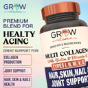 Grow Vitamin Multi Collagen Capsules - Types I, Ii, Iii, V & X | Hydrolyzed Blend With Biotin & Vitamin C For Hair, Skin, Nails 90 Capsules
