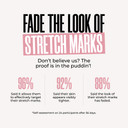 Maëlys Cosmetics Get-Sprung Enriched Stretch Mark Oil - Body Oil For Stretch Marks - Fades Appearance & Reduces Visible Intensity