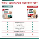 Medical Grade Silicone Scar Tape Advanced Adhesive Formulation (1.6" X 118") Scar Removal Away Strips For Surgical Scars, Silicone Tape & Keloid Scar Treatment, Reusable Silicone Scar Sheets