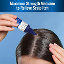 Nizoral Scalp Itch Relief LiquidRelieves Scalp Itch And Soothes, Calms And Hydrates With Maximum Strength Anti-Itch Medicine (Hydrocortisone 1%), 2 Fl Oz
