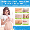 Silicone Scar Sheets - (1.6 X 60) Scar Tape Roll For C-Section, Surgery, Tummy Tuck, Keloids - Invisible, Reusable, Medical-Grade Silicone Scar Strips For Women & Sensitive Skin