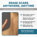 Xeragel 100% Silicone Scar Treatment Ointment 10G  Scar Gel For Smoother, Flatter Scars From Surgery, Burns, Acne & More - For Old & New Scars On Face, Neck & Hands - Hypoallergenic & Fragrance-Free