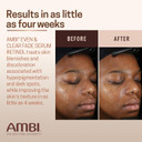 Ambi Even & Clear Fade Serum, Hyperpigmentation Treatment, Hydroquinone-free, Dark Spot Corrector, Results In As Little As 4 Weeks, Retinol, Hyaluronic Acid, Niacinamide, Ceramides, 1 Fl Oz