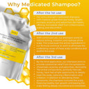 Antifungal Psoriasis Shampoo, Eczema, Shampoo, Seborrheic Dermatitis Shampoo | Soothes Itching, Flaking & Irritation | Repairs Scalp, Strengthens Hair, Stimulates Regrowth | Medicated Scalp Treatment