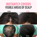 Hairline Powder (Black) + Hair Fiber (Black): Boldify Bundle That Instantly Conceals Hair Loss Hair Powder For Thinning Hair, Root Cover Upblack