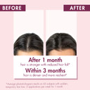 Klorane Strengthening Serum With Quinine And Edelweiss For Thinning Hair, Supports Thicker, Stronger, Healthier Hair, For Men And Women, Paraben, Silicone And Sulfate Free, 3.3 Fl Oz