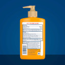 Gold Bond Medicated Anti-Itch Body Lotion, 5.5 Oz. (Pack Of 4), Steroid Free, Fast Acting Itch Relief Gold Bond Medicated Anti-Itch Body Lotion, 5.5 Oz. (Pack Of 4), Steroid Free, Fast Acting Itch Relief