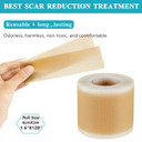 Silicone Scar Sheets (1.6 x 120 Inch), Silicone Scar Tape, Professional Silicone Scar Strips for Surgery Scars, C-Section, Burn, Acne, and Keloid, Soft,Reusable and Painless