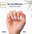 Onsen Secret Essential Nail Reboot Kit (Serum) - Professional Nail File, 3-Way Nail Buffer Block Nail File W/Replacement Pads & Nail Strengthening Cuticle Cream For Healthy Nailsessential Nail Reboot Kit (Serum)