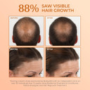 Bosrevive Volumizing Shampoo, Conditioner, And Kit For Hair Regrowth, Noticeably Thinning Hair, Hair Thickening Formula, Color Safe, Starter Set And Multiple Sizes10.1 Fl Oz