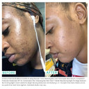 Urban Skin Rxã¢Â® Mega Moisture Illuminating Nighttime Face Cream | Combats Signs Of Aging, Helps Prevent Dry Skin And Locks In Moisture, Formulated With Vitamin E, Green Tea, & Shea Butter | 1.7 Oz