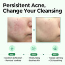 Some By Mi Aha Bha Pha 30 Days Miracle Cleansing Bar - 3.73Oz, 106G - Mild Exfoliating Body Cleansing Soap - Moisturizing Effect, Pore And Sebum Care For Sensitive Skin - Body Skin Care