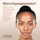 Ambi Even & Clear Intense Clarifying Toner, 8 Ounce