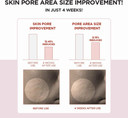 Skin1004 Madagascar Centella Poremizing Clear Toner 7.1 Fl.Oz, 210Ml For Keratin Plug And Sensitive Skin