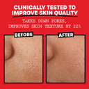 Thayers Alcohol-Free, Hydrating, Unscented Witch Hazel Facial Toner With Aloe Vera Formula, Vegan, Dermatologist Tested And Recommended, 8.5 Oz (Pack Of 2)