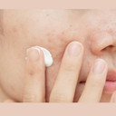 M.A.D Skincare Breakout Control Daily Moisturizer - For Acne Prone Skin 1.7 Oz