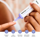 Rescue Balm Post-Blemish Recovery Cream From Hero Cosmetics - Intensive Nourishing And Calming For Dry, Red-Looking Skin - Dermatologist Tested And Vegan-Friendly (15 Ml, 0.5 Fl. Oz)