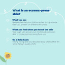 Mustela Pa Stelatopiaã¢Â® Baume Emollient 200Ml / Pa Stelatopiaã¢Â® Emollierende Balsem 200Ml