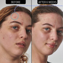 The Inkey List Urea 10% Moisturiser 50Ml | Supersolutions | Targets Severe Dryness | Fragrance-Free | Suitable For Very Dry Skin