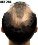 Super Million Hair 40G Set (1 X 40G Hair Building Fibres & 1 X 165Ml Hard Mist) - No.45 Medium Blonde