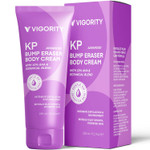 Vigority Kp Bump Eraser For Keratosis Pilaris: Body Moisturizer Exfoliating Cream - Kp Bump Be Gone Treatment For Bumpy Dry Rough Skin Vigority Kp Bump Eraser For Keratosis Pilaris: Body Moisturizer Exfoliating Cream - Kp Bump Be Gone Treatment For Bumpy Dry Rough Skin
