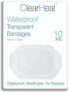 Waterproof Sterile Transparent Adhesive Plaster - 10cm x 12cm, 10pcs Island Dressings with Pad for Wounds, HRT, C-Section & Scar Care - Breathable Second Skin Waterproof Sterile Transparent Adhesive Plaster - 10cm x 12cm, 10pcs Island Dressings with Pad for Wounds, HRT, C-Section & Scar Care - Breathable Second Skin