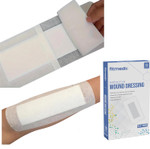 Adhesive Wound Dressings (80mm x 150mm) - **Pack of 10** Sterile Dressings for Wounds, Cuts, Grazes, Diabetic Leg Ulcers, Venous Leg Ulcers & Small Pressure Sores- Hypoallergenic Plasters for Wounds Adhesive Wound Dressings (80mm x 150mm) - **Pack of 10** Sterile Dressings for Wounds, Cuts, Grazes, Diabetic Leg Ulcers, Venous Leg Ulcers & Small Pressure Sores- Hypoallergenic Plasters for Wounds