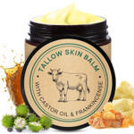 2 Pack Handmade Beef Tallow With Frankincense And Castor Oil Face Balm, 100% Grass-Fed Tallow For Skin Care, Face & Body Moisturizer For Sensitive Skin & Dry Skin Age Defying, Natural Lotion 2 Pack Handmade Beef Tallow With Frankincense And Castor Oil Face Balm, 100% Grass-Fed Tallow For Skin Care, Face & Body Moisturizer For Sensitive Skin & Dry Skin Age Defying, Natural Lotion