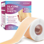 Silicone Scar Sheets,Silicone Scar Tape Roll,Medical Grade Silicone Tape For Scar Removal,Reusable Professional Scar Treatment Patch For C-Section,Keloids,Surgical,Acne (Roll Size 1.6''X75''-1.9M) Silicone Scar Sheets,Silicone Scar Tape Roll,Medical Grade Silicone Tape For Scar Removal,Reusable Professional Scar Treatment Patch For C-Section,Keloids,Surgical,Acne (Roll Size 1.6''X75''-1.9M)