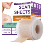 Silicone Scar Sheets,Silicone Scar Tape,Scar Tape For Surgical,C-Section,Tummy Tuck,Keloid(1.6"X 120" Roll-3M) Keloid Bump Removal