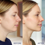 Stylia V Line Lifting Collagen Face Mask - Double Chin Strap For Women - Jawline Shaper Face Lift Tape - Neck Lift Collagen Mask - Chin Strap For Sleeping - Hyaluronic Acid, Aloe Vera, Cica 5Pc Stylia V Line Lifting Collagen Face Mask - Double Chin Strap For Women - Jawline Shaper Face Lift Tape - Neck Lift Collagen Mask - Chin Strap For Sleeping - Hyaluronic Acid, Aloe Vera, Cica 5Pc