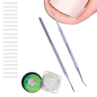(20+2) Pack Professional Ingrown Toenail Correction Treatment Kit, 2 Tool Toenail File And Lifter, 20Pcs Professional Straightener Strips Recover Clips